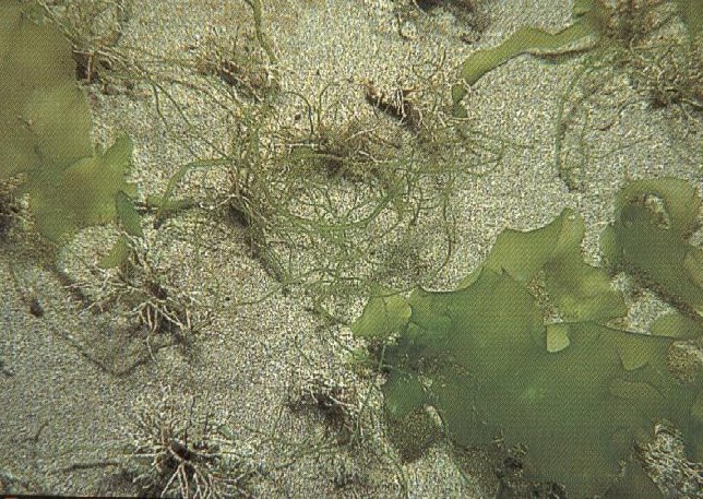 Benthic Microalgae